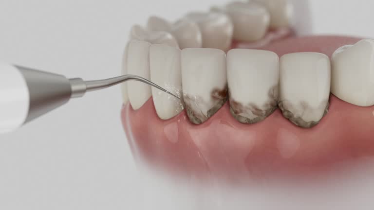Trusted Emergency Dentist service in Gadsden, AL - Dentist Open Now